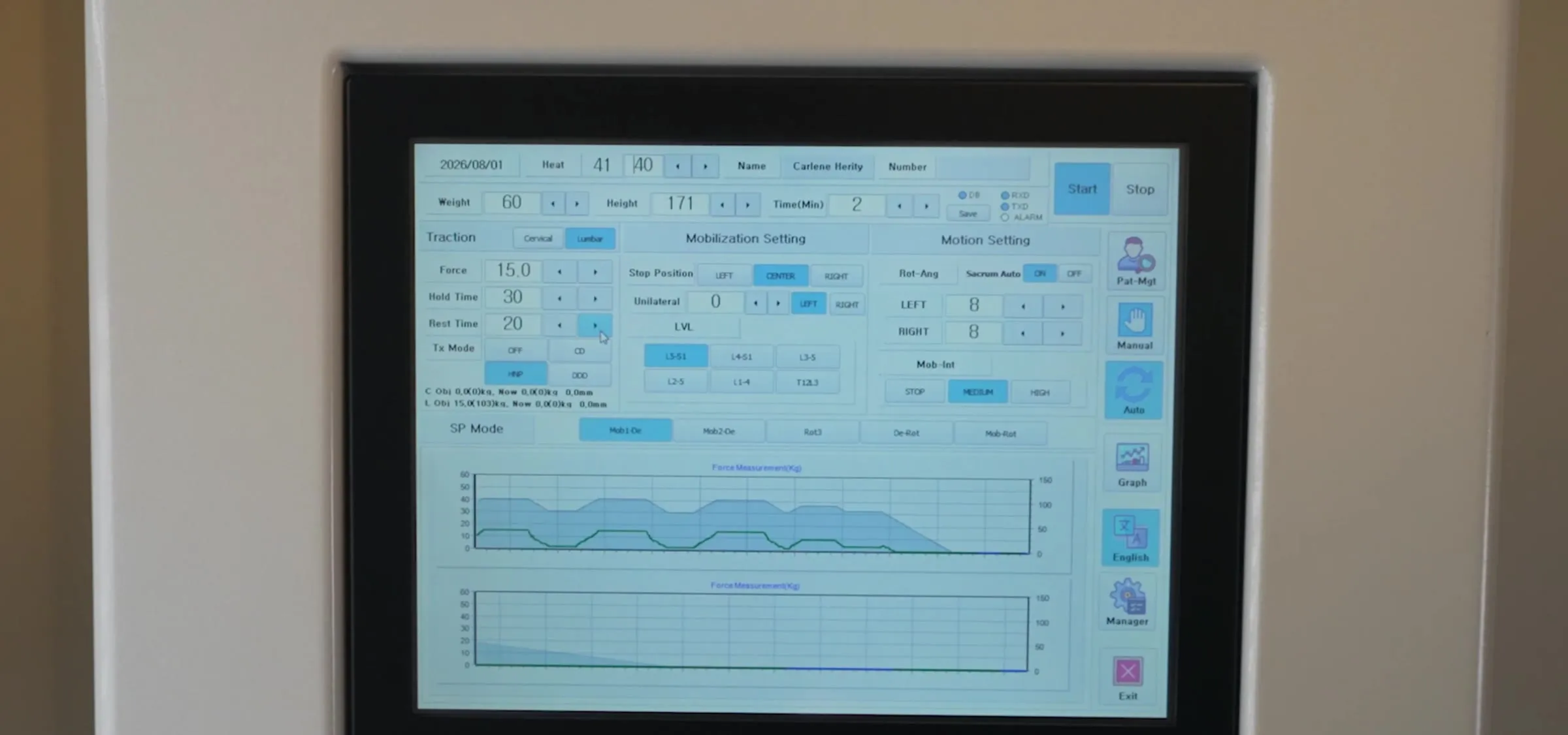 The computer console showing the gentle traction cycles during a spinal decompression session