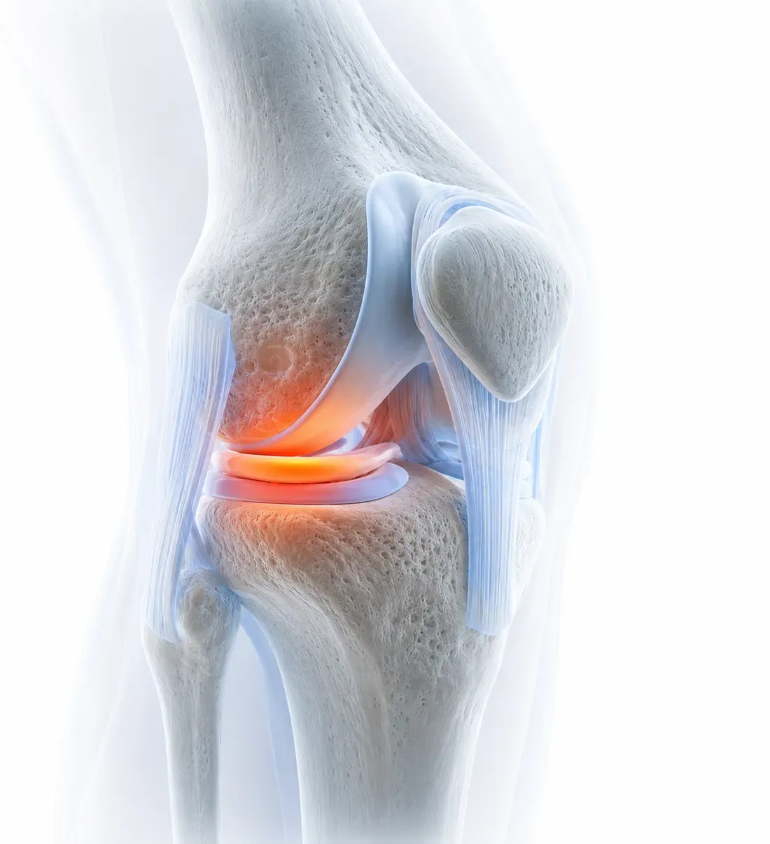 Knee pain, anatomical illustration